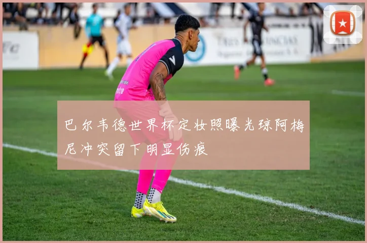 巴尔韦德世界杯定妆照曝光琼阿梅尼冲突留下明显伤痕
